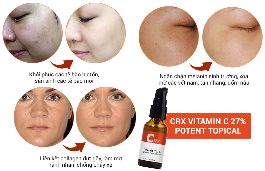 Tác dụng CRX Vitamin C 27% Potent Topical